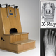 Illustration for article titled When X-rays were given in shoe stores